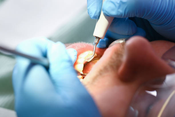Best Pediatric Emergency Dentist in Moorpark, CA