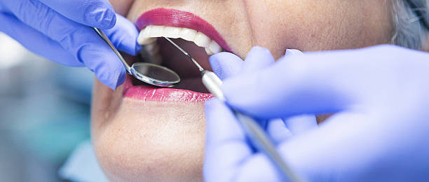 Best Broken or Cracked Tooth Emergency Dentist in Moorpark, CA
